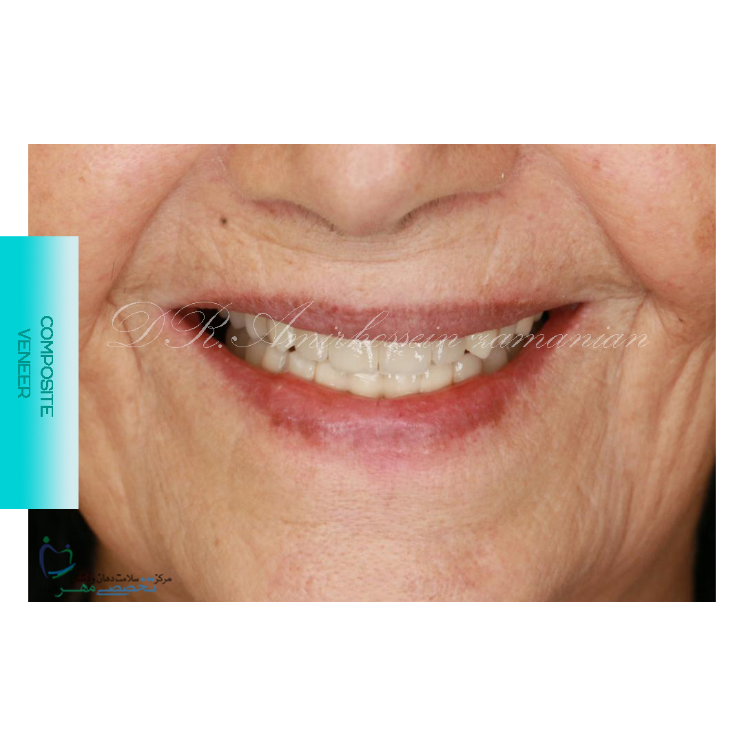 دکتر امیرحسین زمانیان متخصص پروتز های دندانی